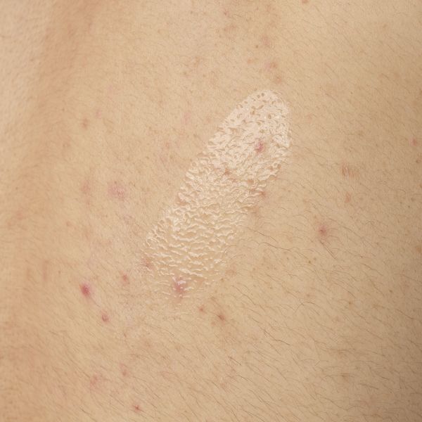 Salicylic Acid 0.5% Body Serum - Image 4